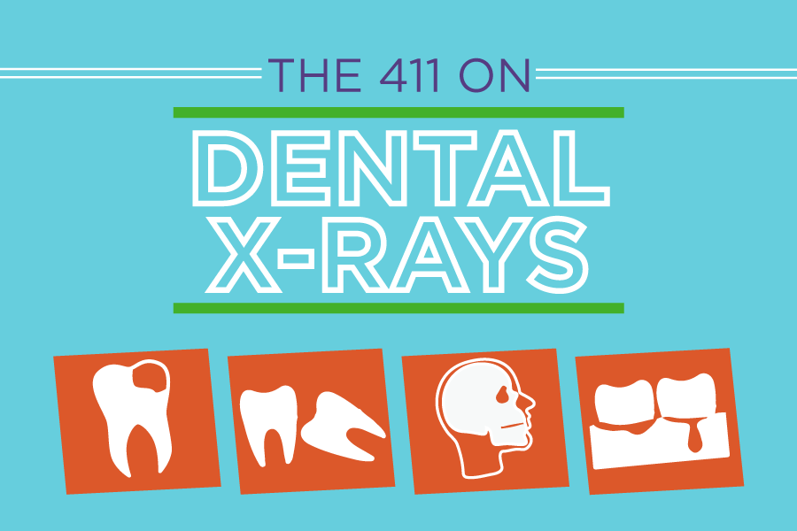 Facts About Dental X Rays Infographic Delta Dental Of Iowa